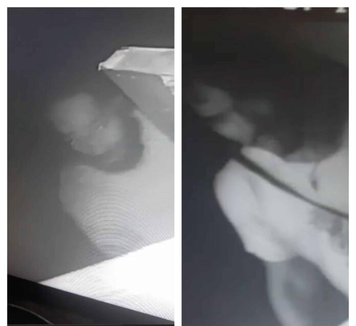 BREAK-IN-scaled-e1741365591709.jpg
